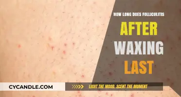 Understanding Folliculitis Duration Post-Waxing: A Comprehensive Guide