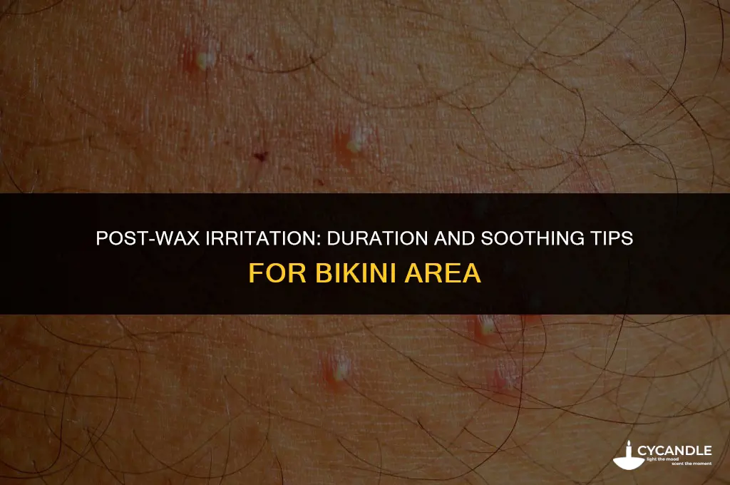 how long does irritation last after bikini wax