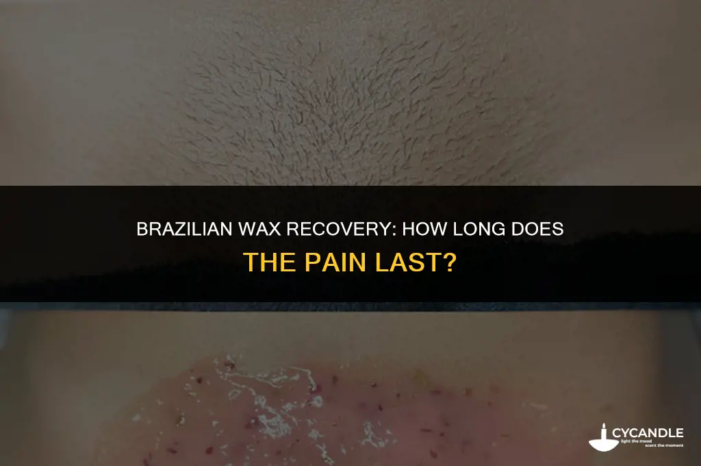 how long does it hurt after getting a brazilian wax
