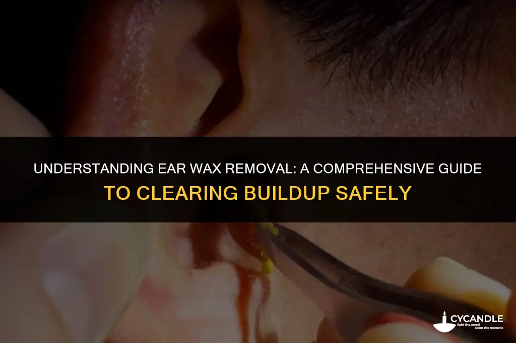 how long does it take to clear ear wax