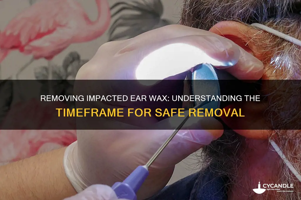 how long does it take to remove impacted ear wax