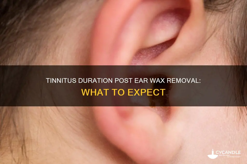 how long does tinnitus last after ear wax removal