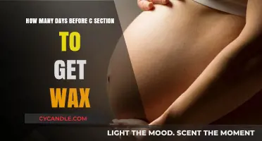 Preparing for a C-Section: The Ideal Time for a Pre-Surgery Wax