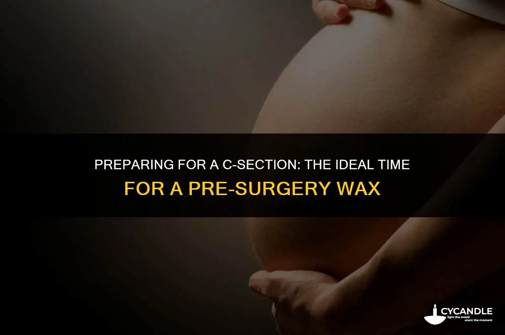 how many days before c section to get wax