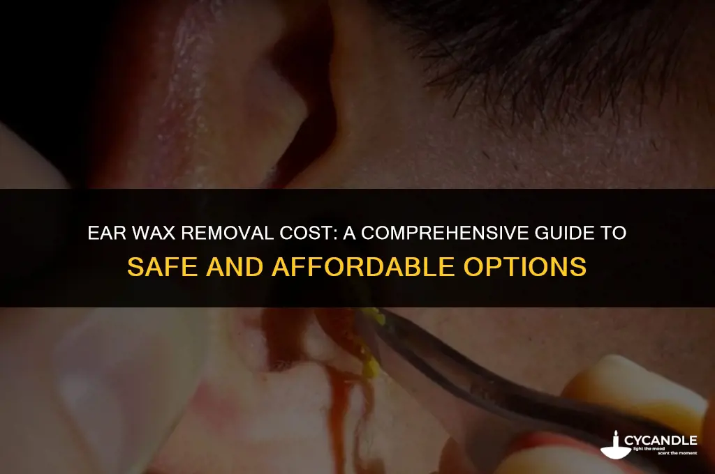 how much cost to remove ear wax