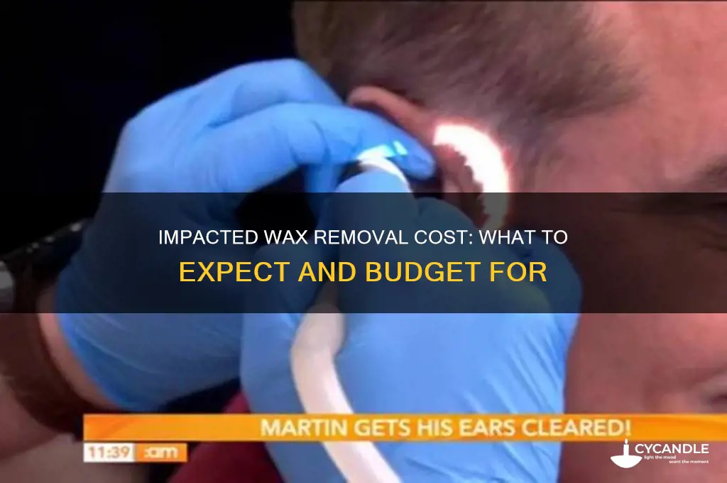 how much does it ost to get impacred wax removed