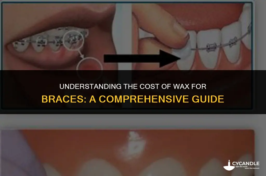 how much does wax for braces cost