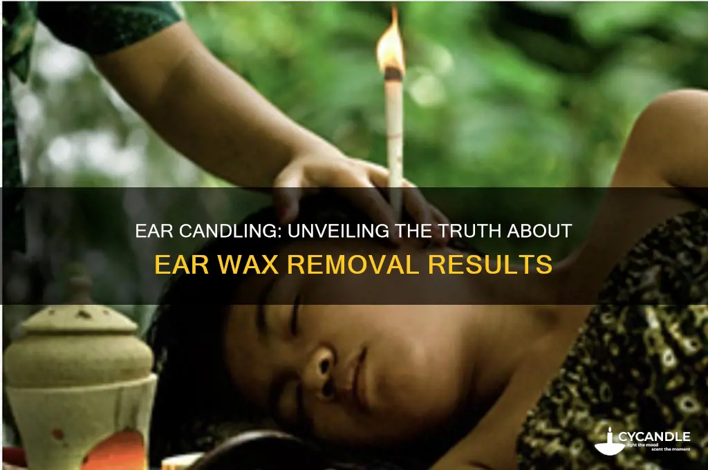 how much ear wax comes out with ear candling