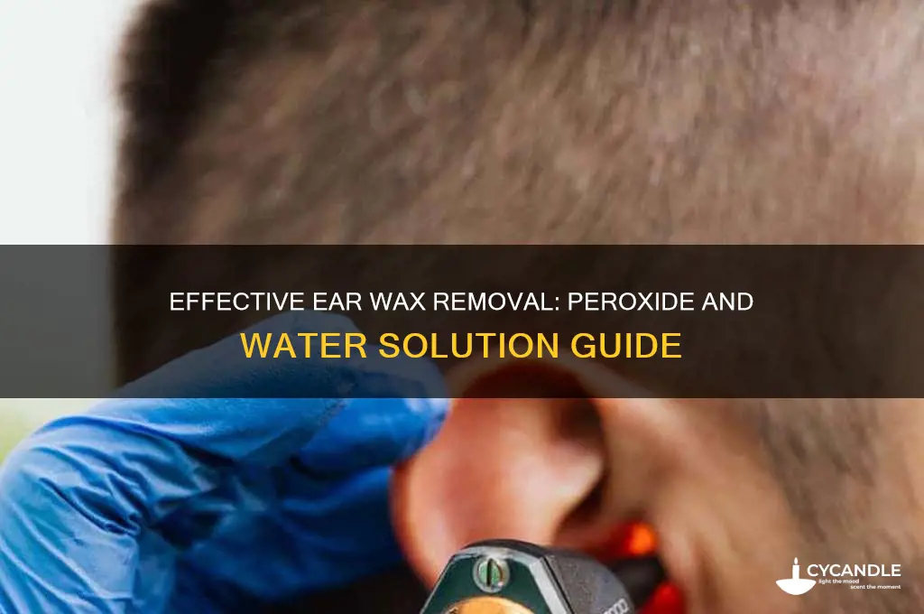 how much peroxide and water for ear wax removal