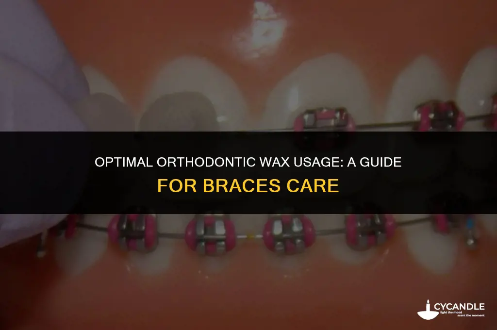 how often should i use orthodontic wax