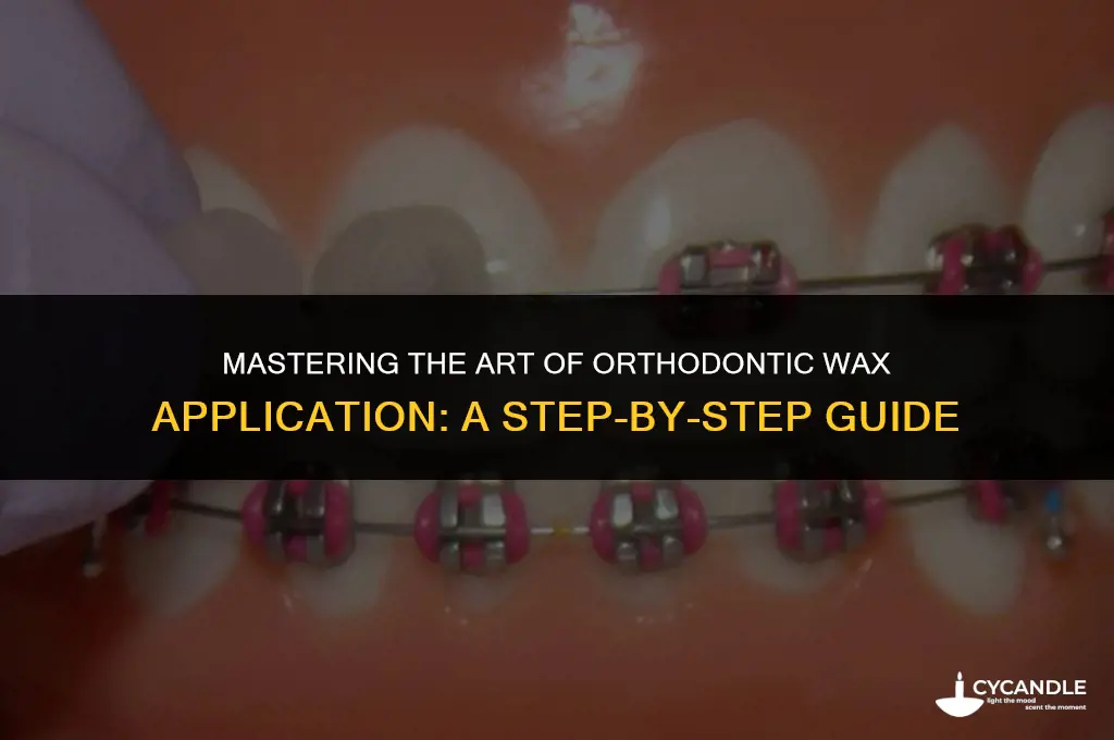 how to apply orthodontic wax