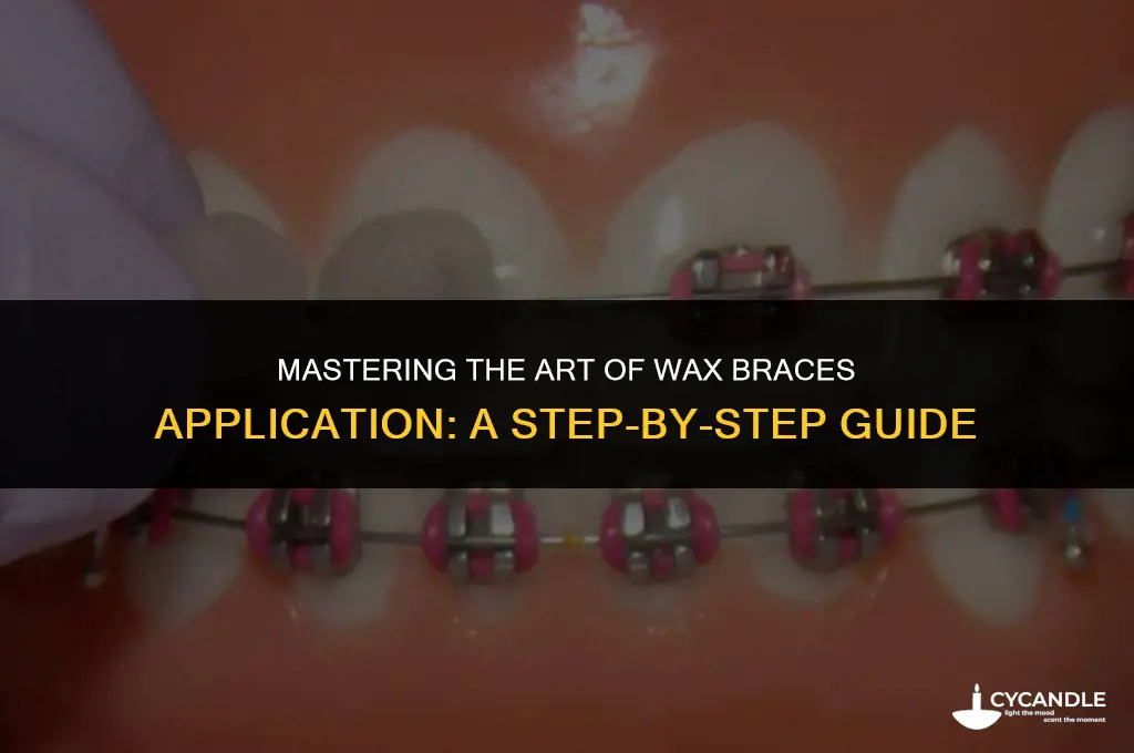 how to apply wax braces