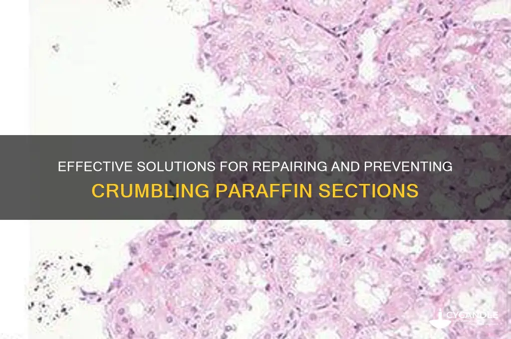 how to deal with crumbling sections paraffin