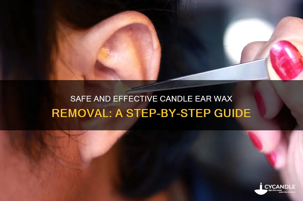 how to do candle ear wax removal