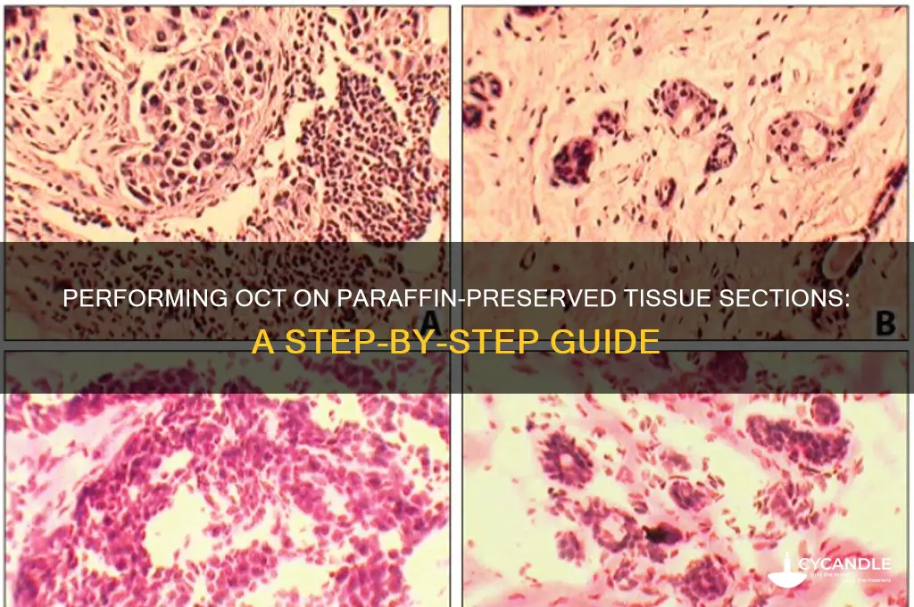 how to do oct on paraffin preserved sections