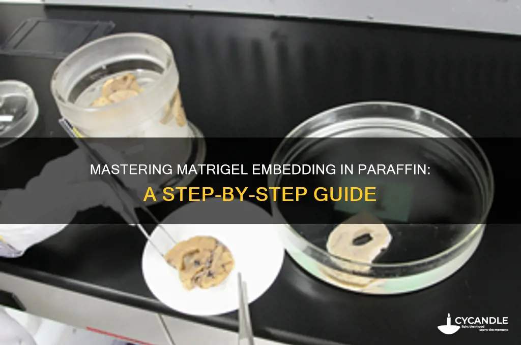 how to embed matrigel in paraffin