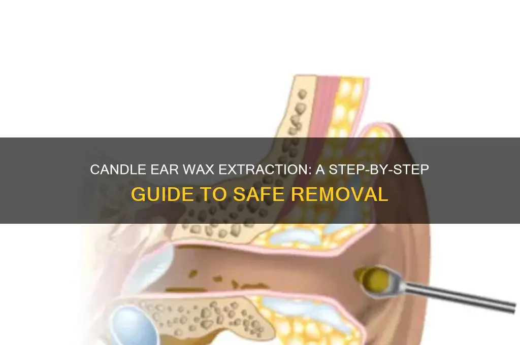 how to extract ear wax with a candle