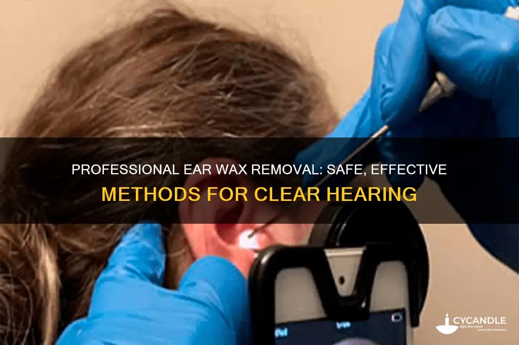 how to get ear wax removed professionally