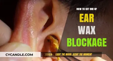 Effective Ways to Safely Remove Ear Wax Blockage at Home