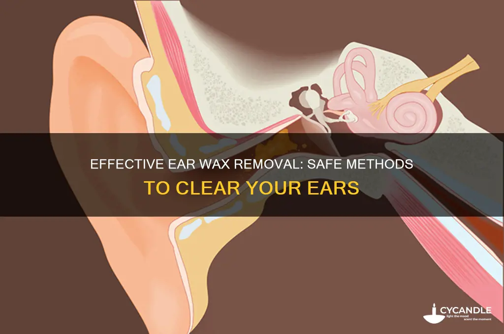 how to get rid of ear wax removal