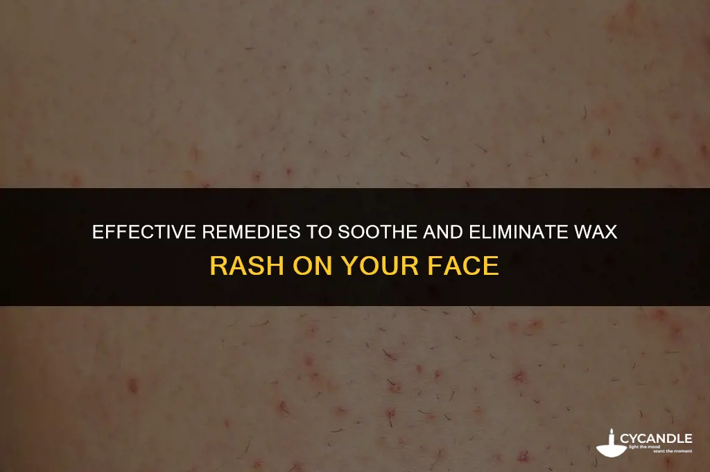 how to get rid of wax rash on face