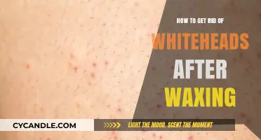 Banish Whiteheads Post-Wax: A Comprehensive Guide to Clear Skin