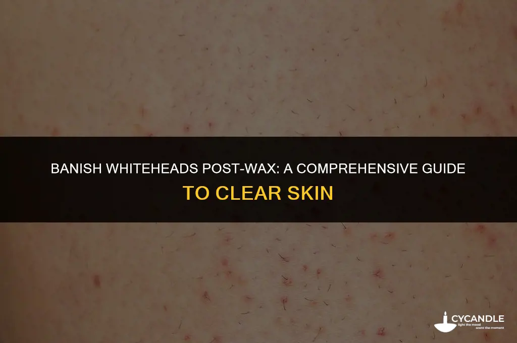 how to get rid of whiteheads after waxing