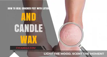 Heal Cracked Feet: Lotion and Candle Wax Remedy Guide