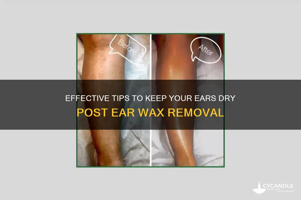 how to keep ear dry after ear wax removal