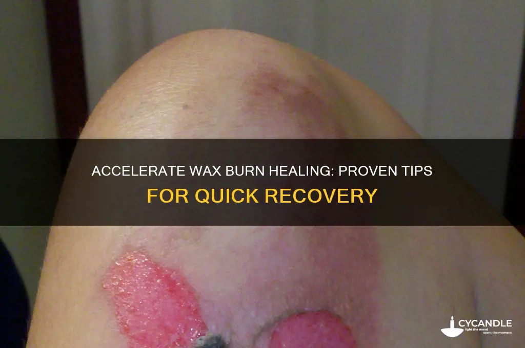 how to make a wax burn heal faster