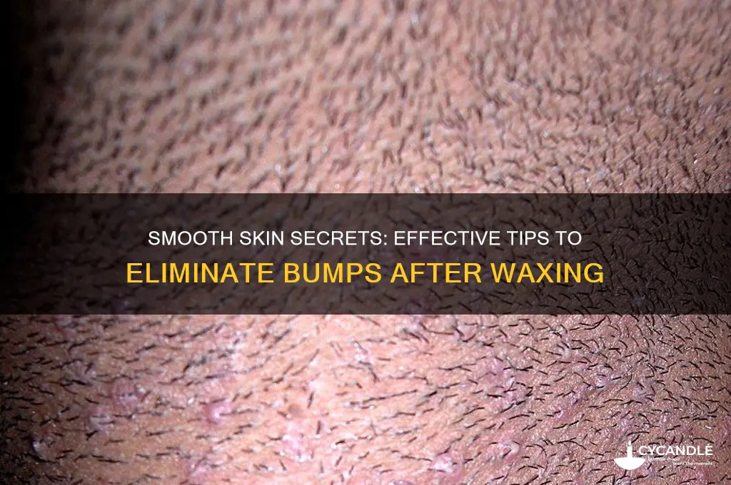 how to make bumps go away after waxing