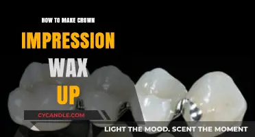 Mastering Crown Impressions: A Step-by-Step Wax-Up Guide