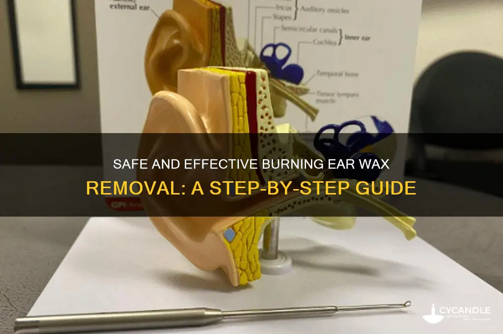 how to make the burning ear wax removal