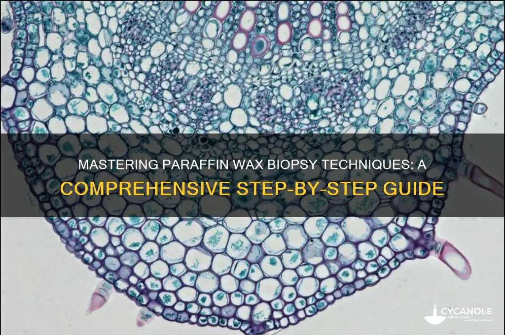 how to paraffin wax biopsy