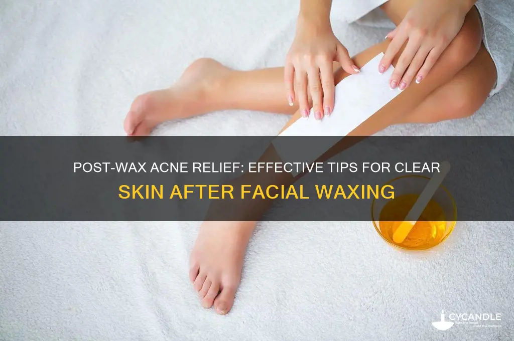 how to remove acne after face wax