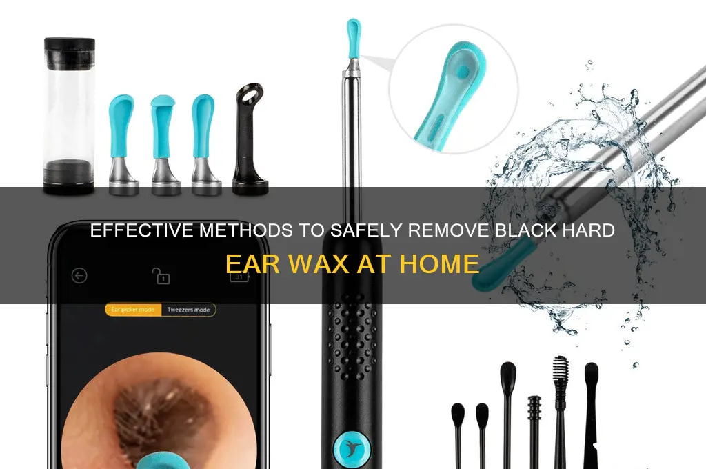how to remove black hard ear wax