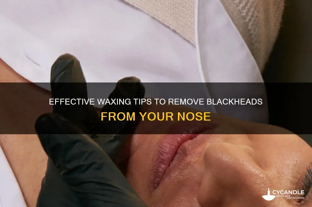 how to remove blackheads from nose with wax