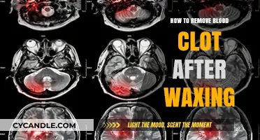 Effective Tips to Safely Remove Blood Clots After Waxing at Home