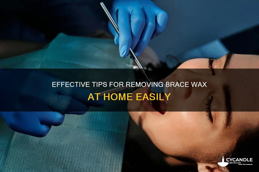 how to remove brace wax