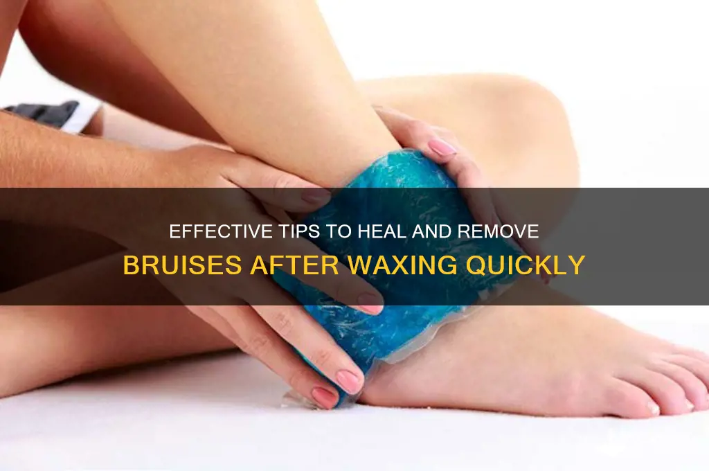 how to remove bruises from waxing
