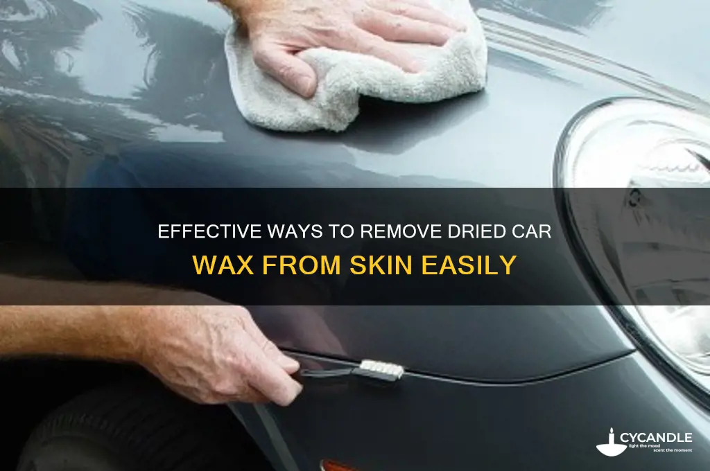 how to remove car wax from skin when dried