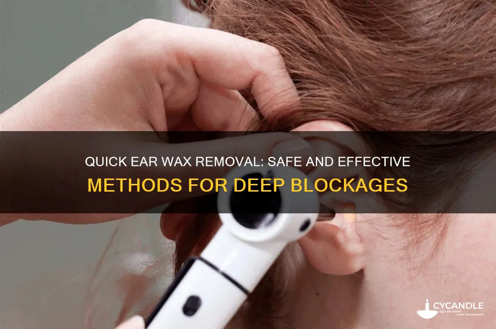 how to remove deep ear wax blockage fast