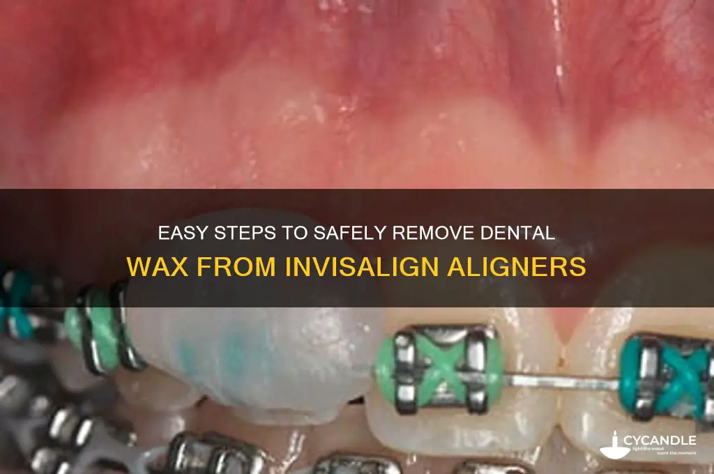 how to remove dental wax for invisalign