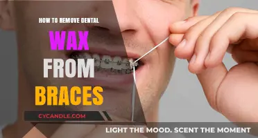 Easy Steps to Safely Remove Dental Wax from Braces