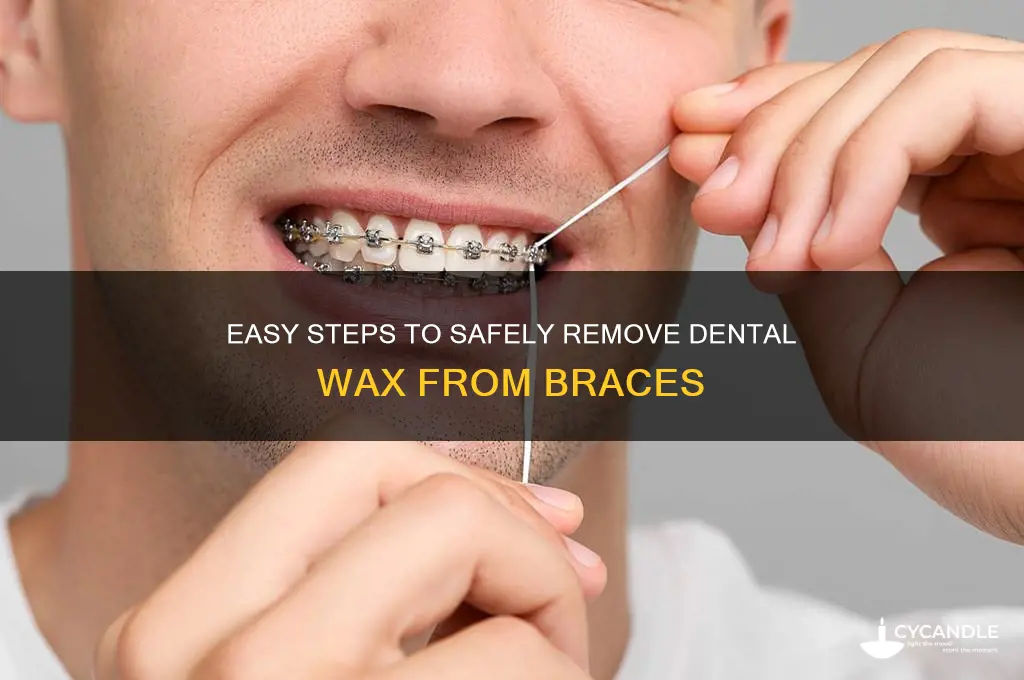 how to remove dental wax from braces