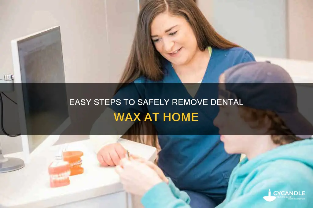 how to remove dental wax