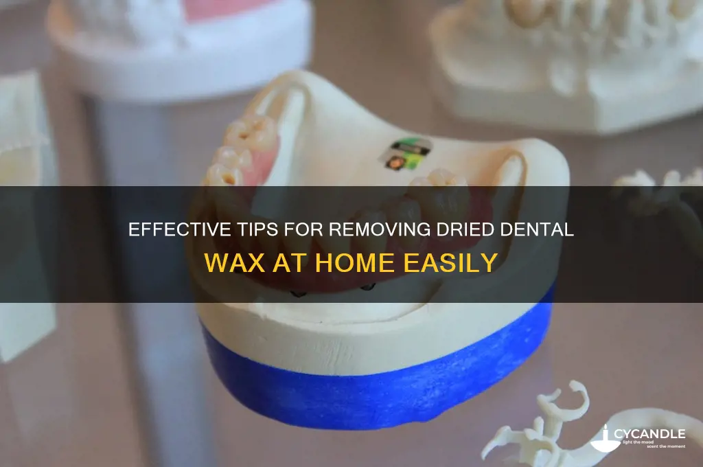 how to remove dried dental wax