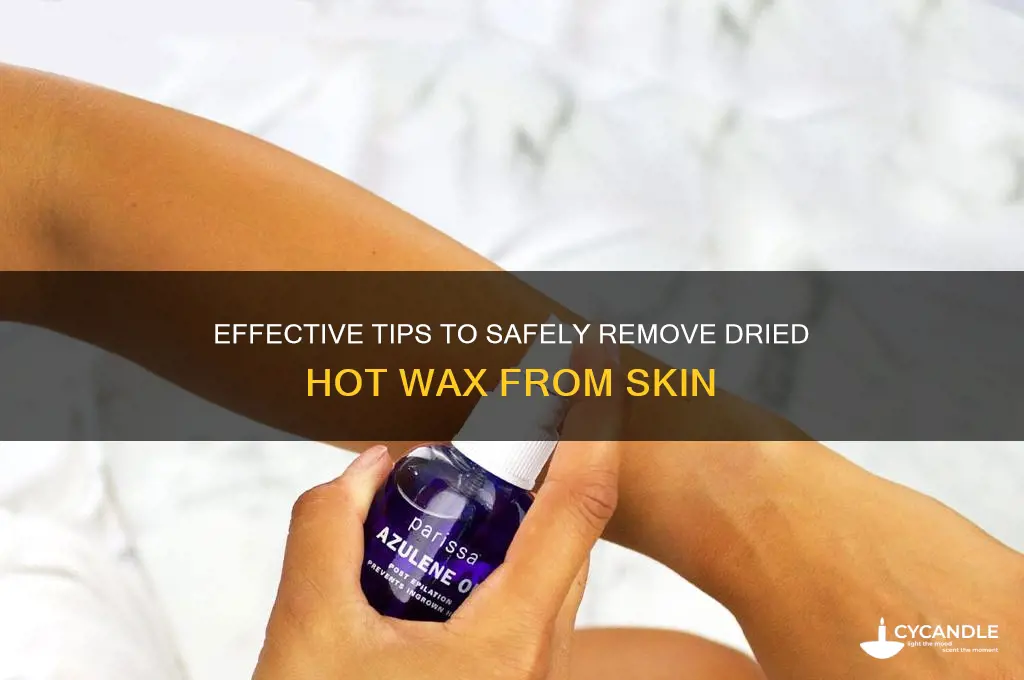 how to remove dried hot wax from skin