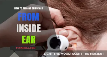 Safe and Effective Ways to Remove Dried Ear Wax at Home