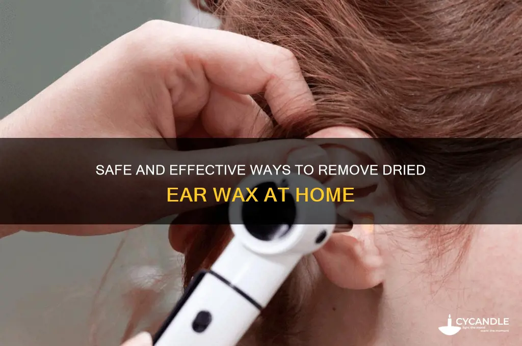 how to remove dried wax from inside ear